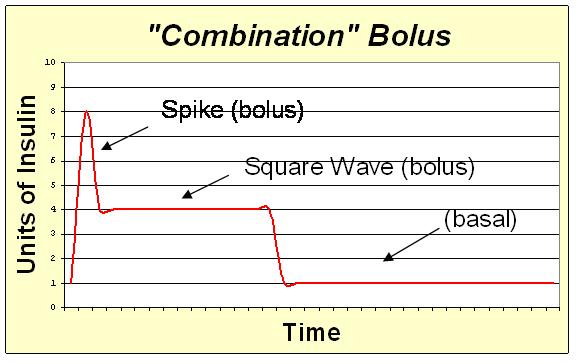 combo_bolus